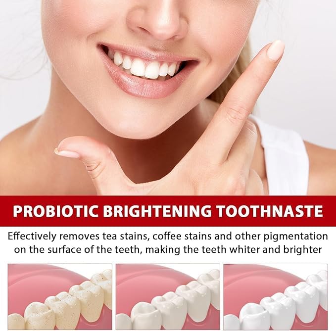 SP-4 Ultra+ Whitening Toothpaste – Pack of 2 (200g Total) ⭐⭐⭐⭐4.9/5