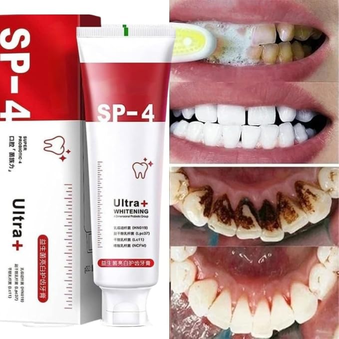 SP-4 Ultra+ Whitening Toothpaste – Pack of 2 (200g Total) ⭐⭐⭐⭐4.9/5